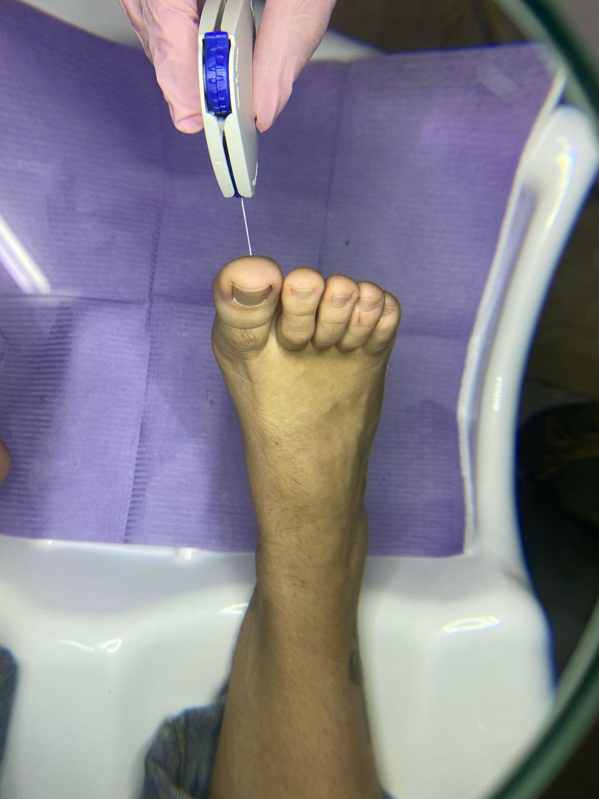 Fondo de Pie o Cribado - Podología La Plata